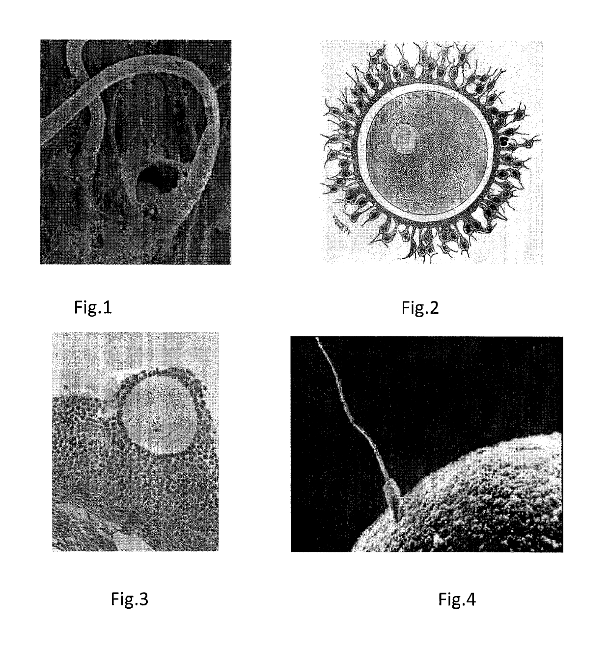 Compressed capsules for giving birth to males