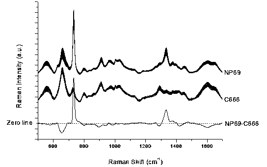 Method for distinguishing cancer cells through surface enhanced Raman spectroscopy