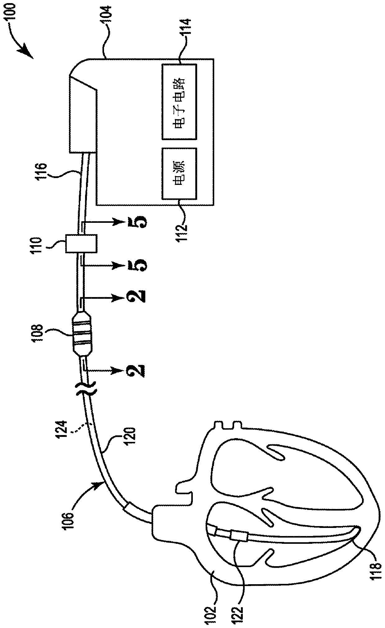 Infection fighting drug eluting device