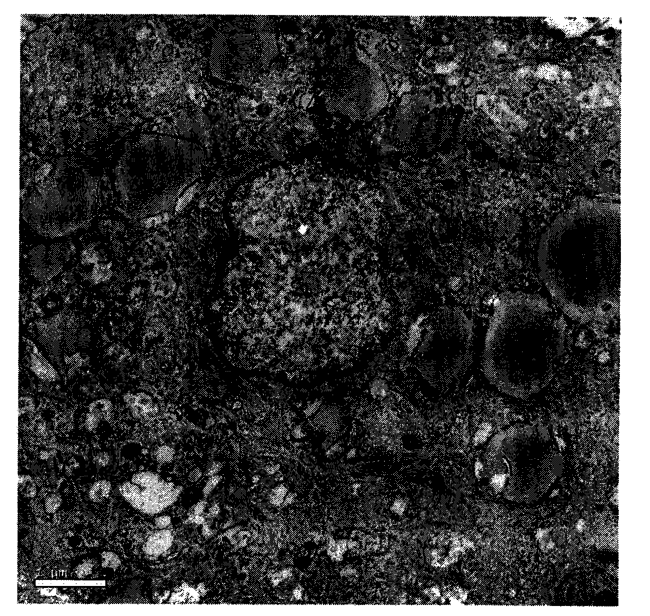 Method for extracting unsaturated fatty acid composition from humen amniotic epithelial cells, and application thereof