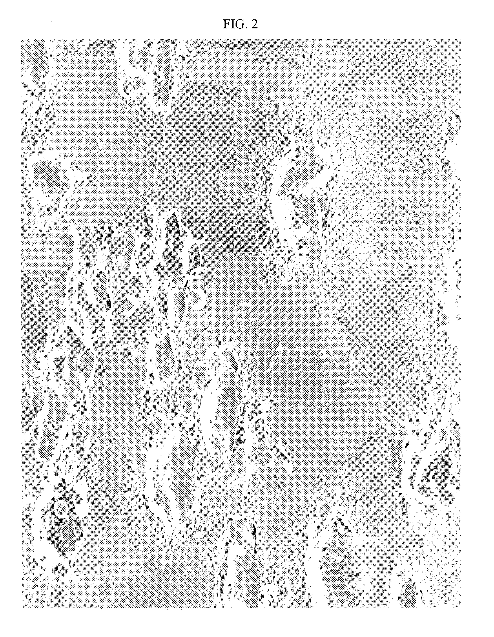 Deposition and Selective Removal of Conducting Helplayer for Nanostructure Processing