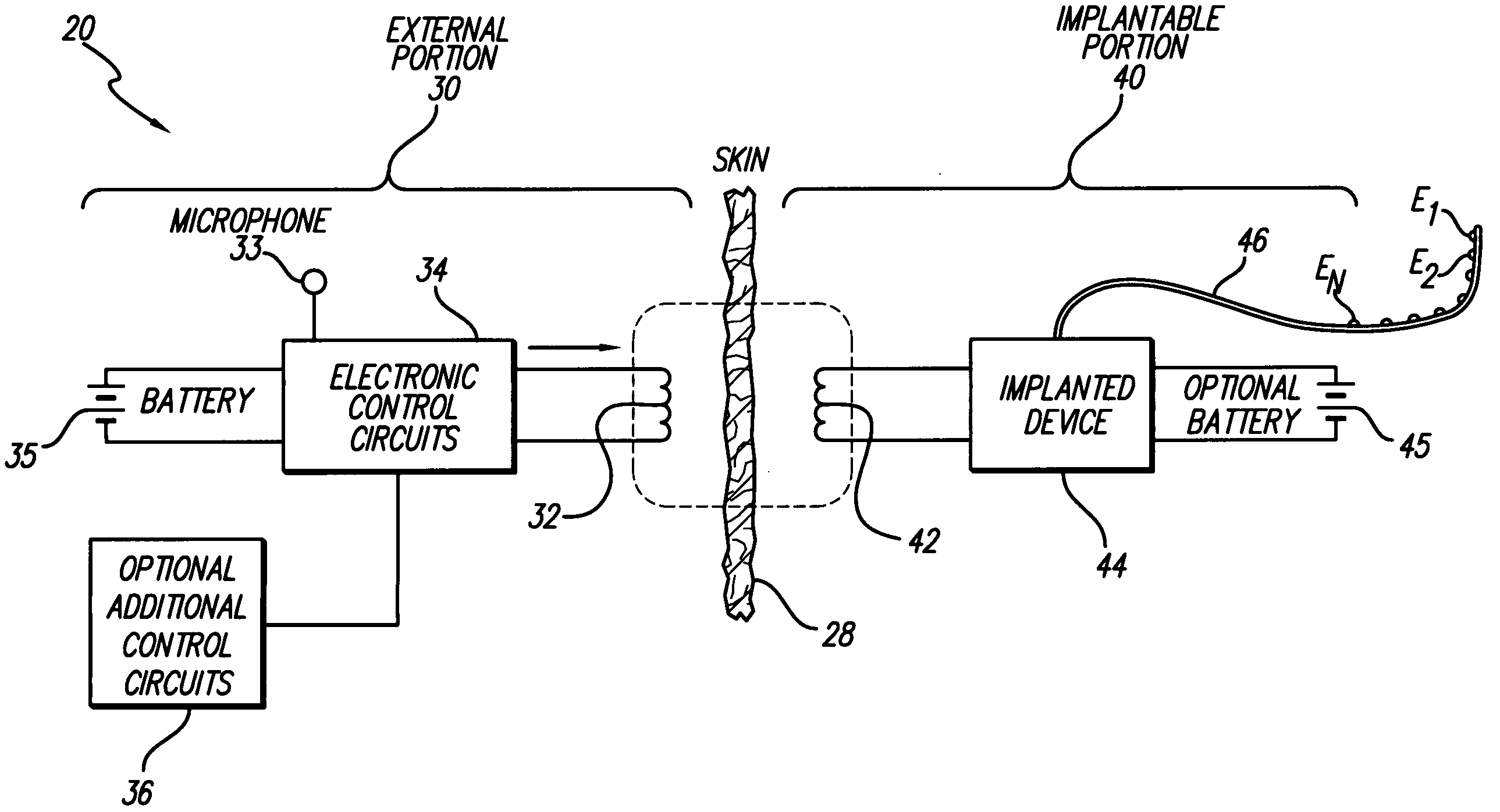 Cochlear stimulation device