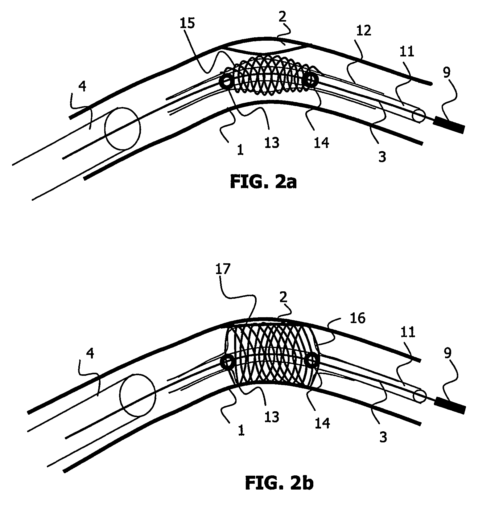 Medical viewing system and method for detecting borders of an object of interest in noisy images