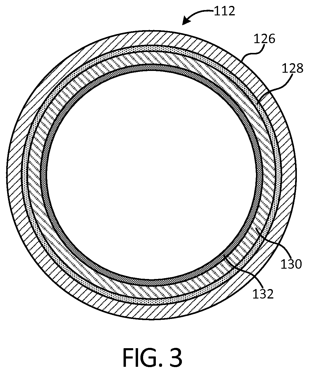 Percutaneous implantable nuclear prosthesis