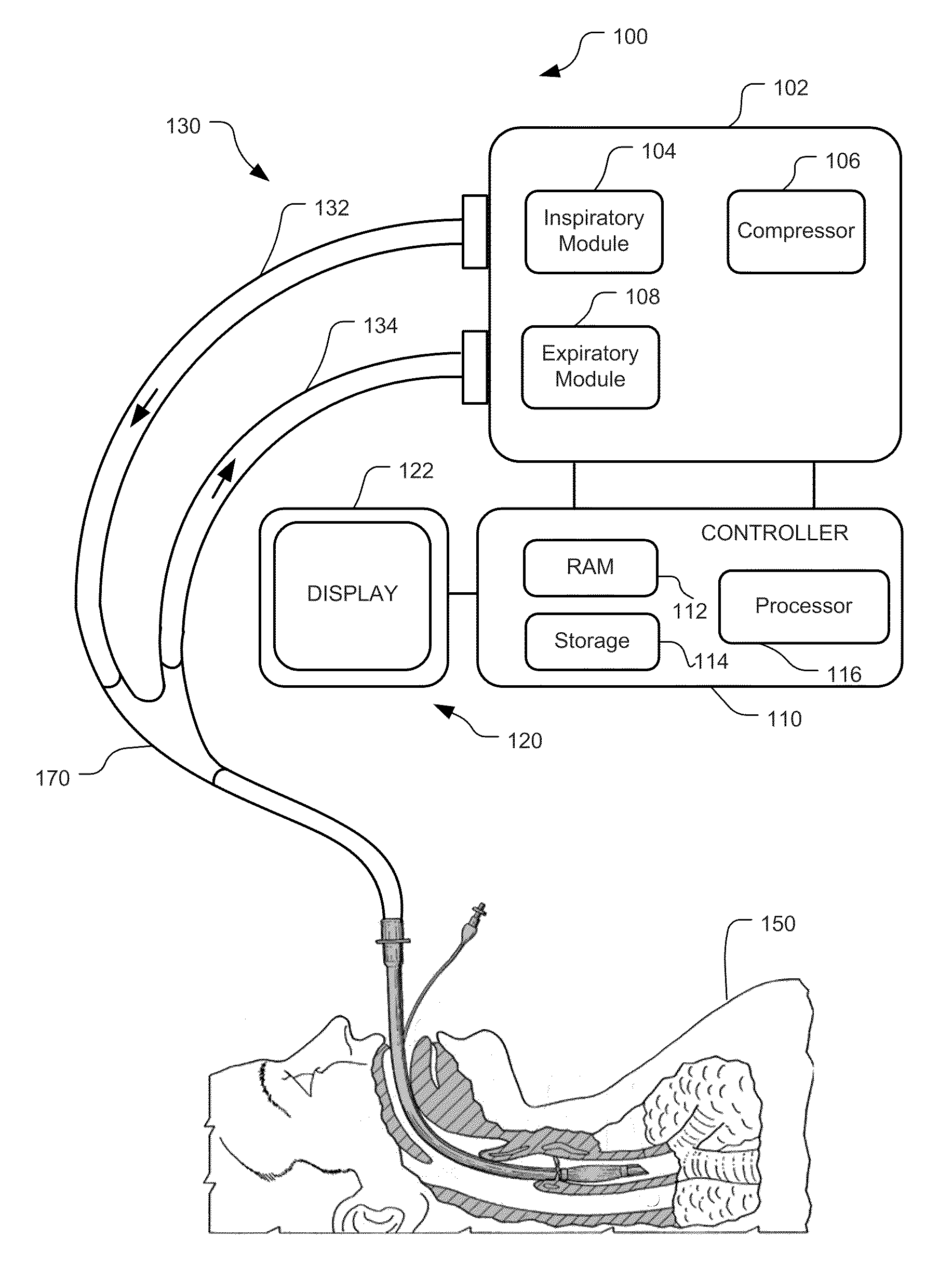 Visual Indication Of Settings Changes On A Ventilator Graphical User Interface