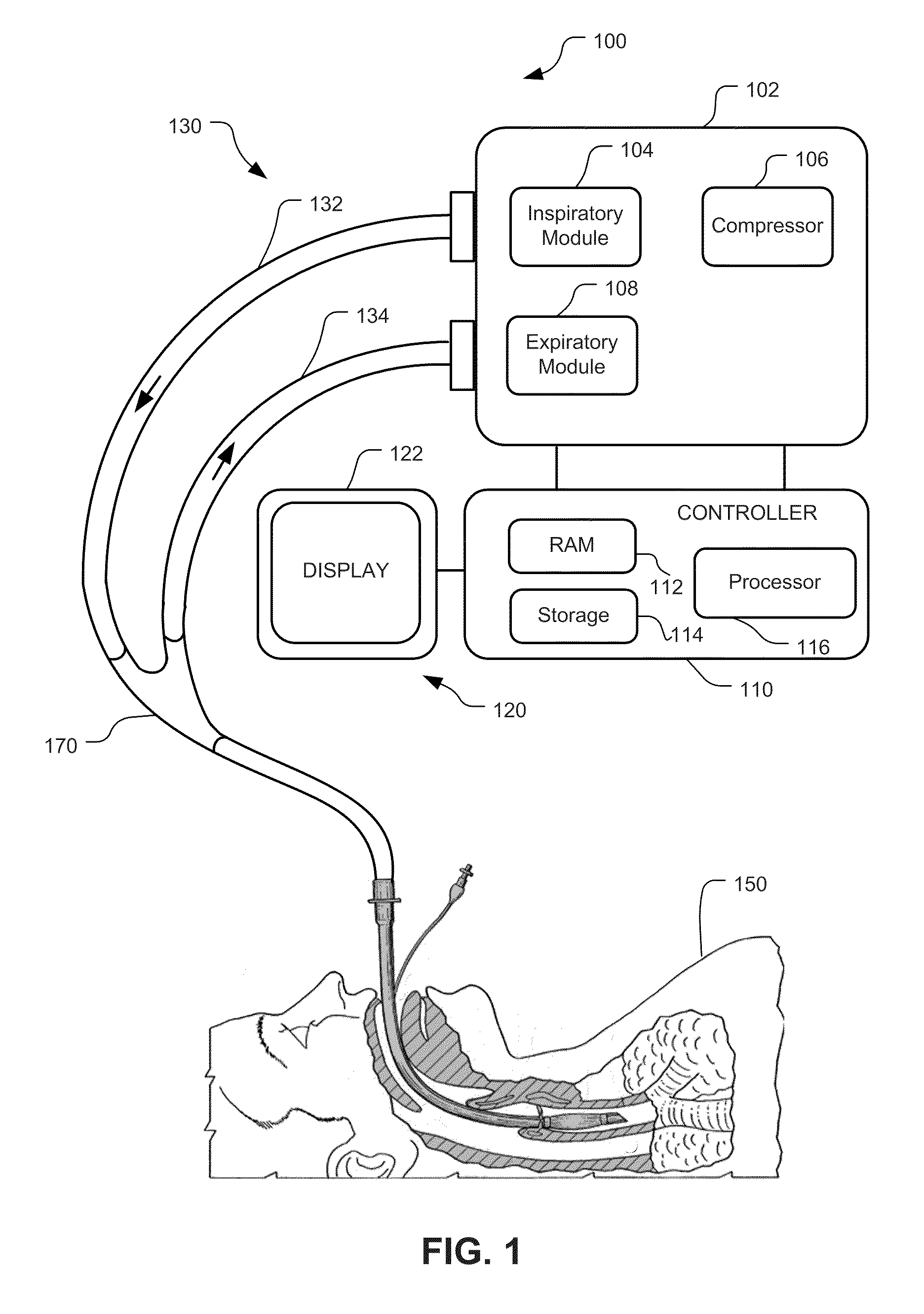 Visual Indication Of Settings Changes On A Ventilator Graphical User Interface