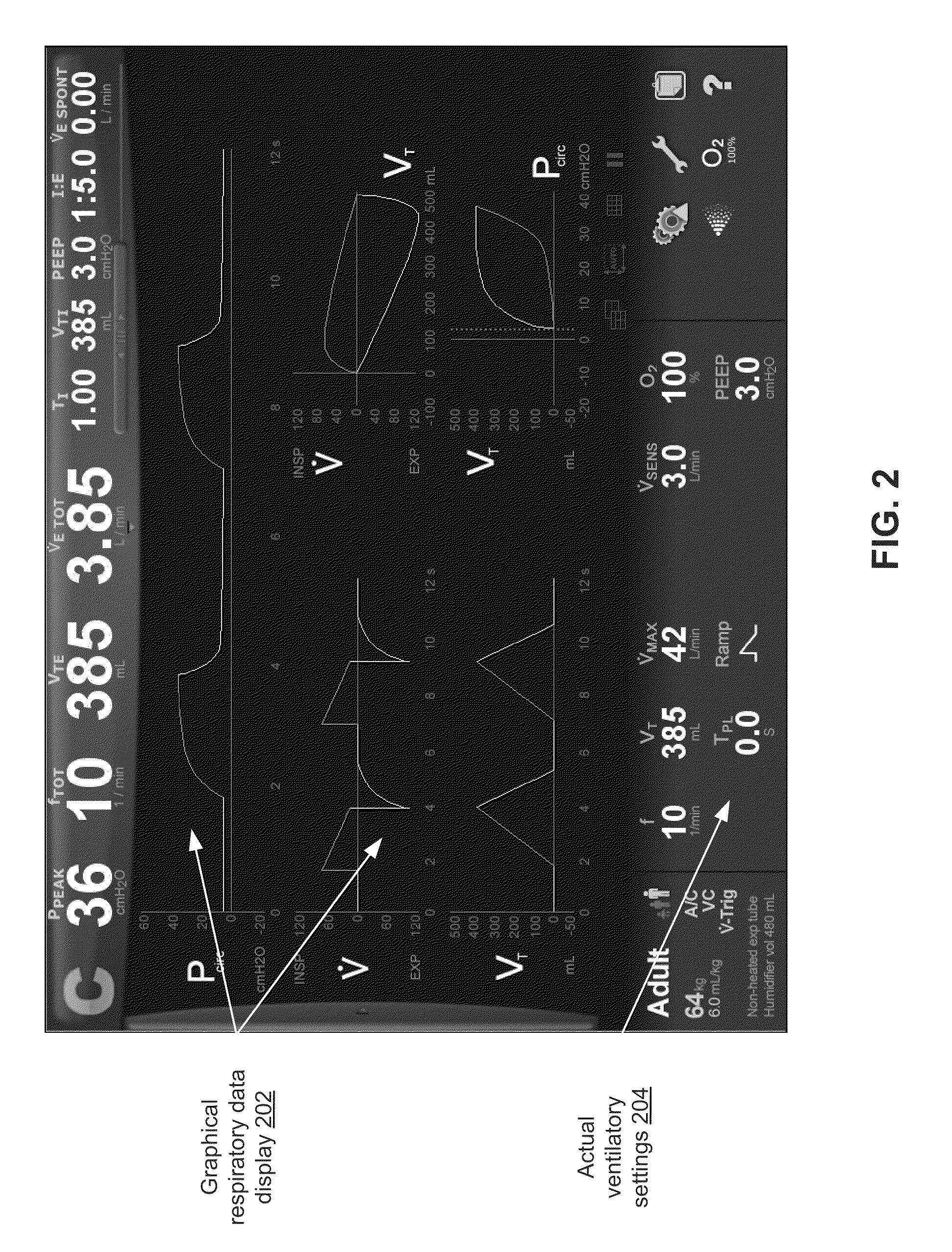 Visual Indication Of Settings Changes On A Ventilator Graphical User Interface