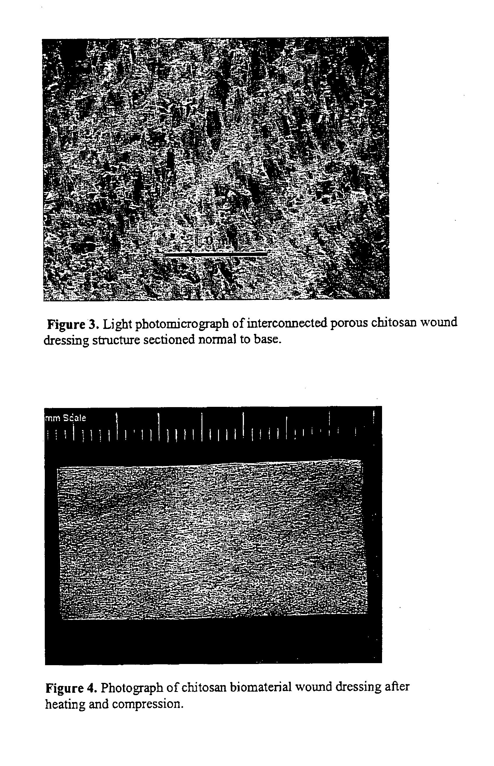 Wound dressings, apparatus, and methods for controlling severe, life-threatening bleeding