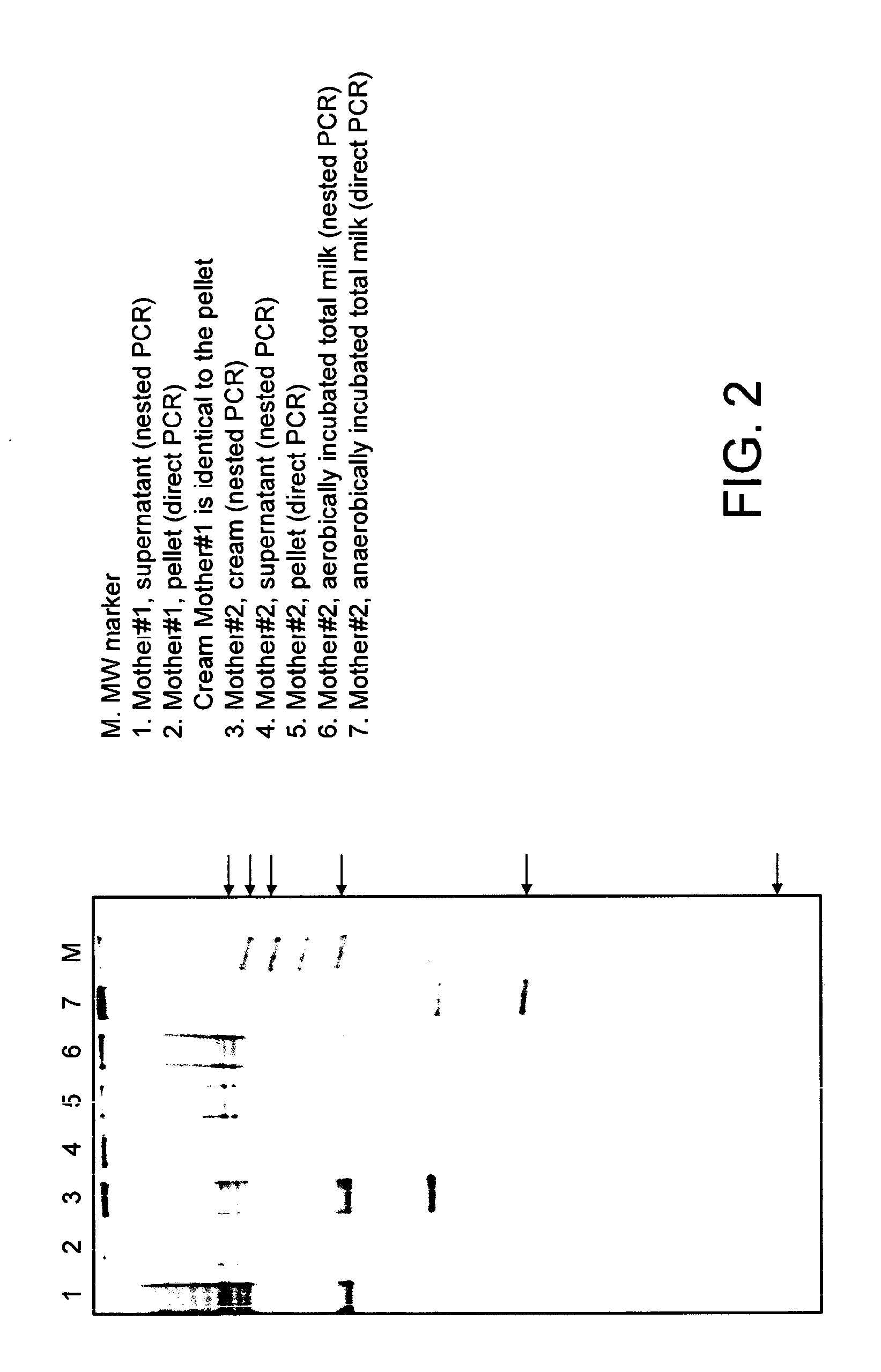 Infant formula with probiotics and milk fat globule membrane components