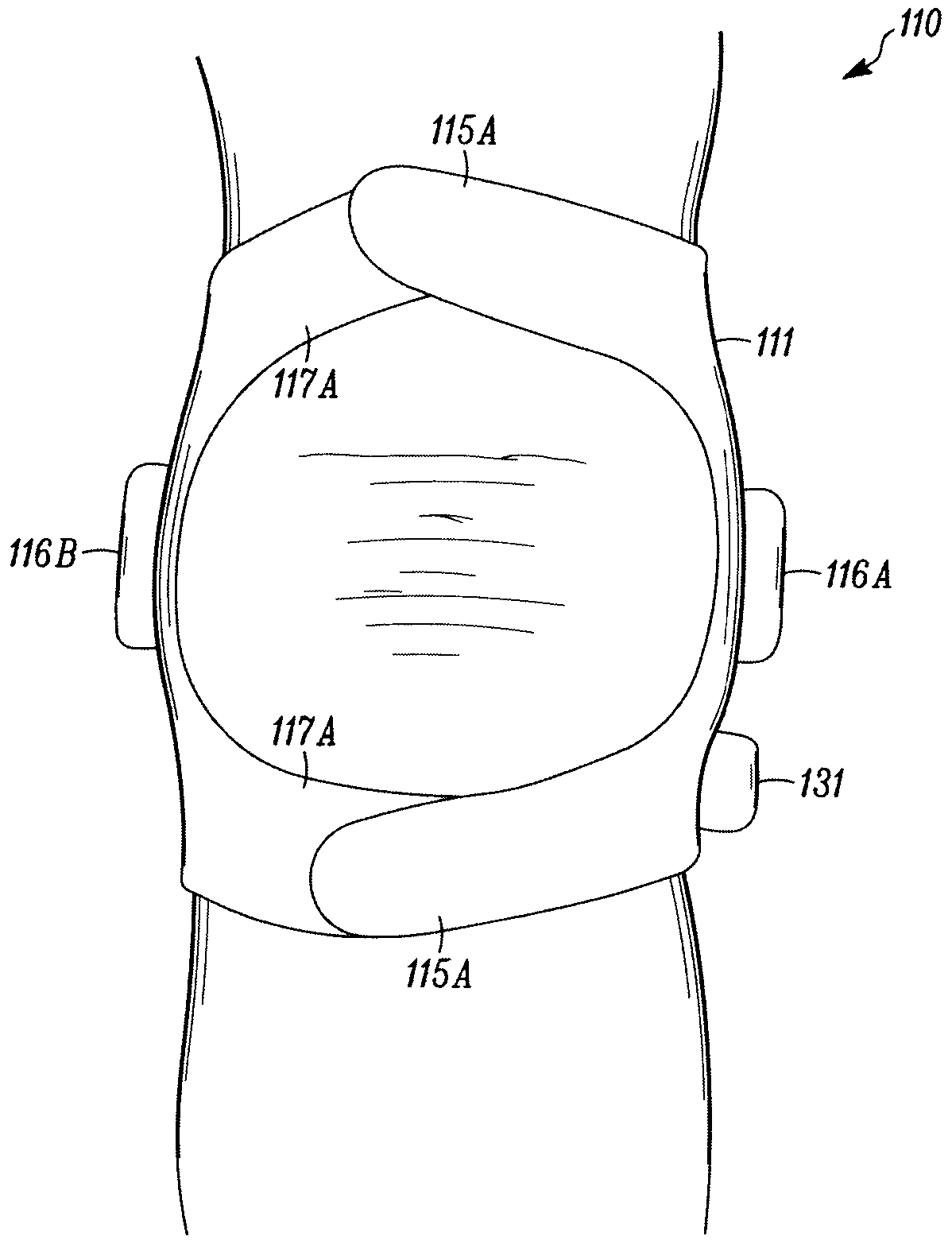 Stimulation Device for Treating Osteoarthritis