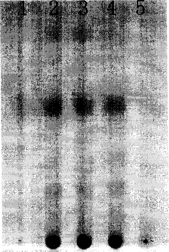 Quality control method of kidney beneficial bone fortifying capsule