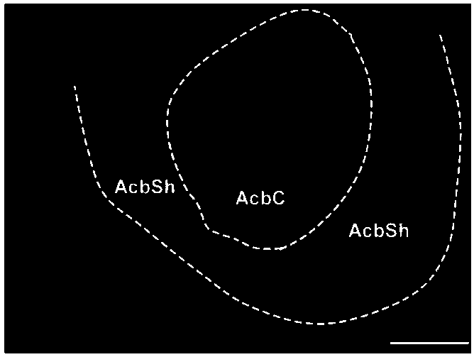 Composition of specifically excitable GABAergic neurons in nucleus accumbens and its application in improving abnormal behavior in schizophrenia