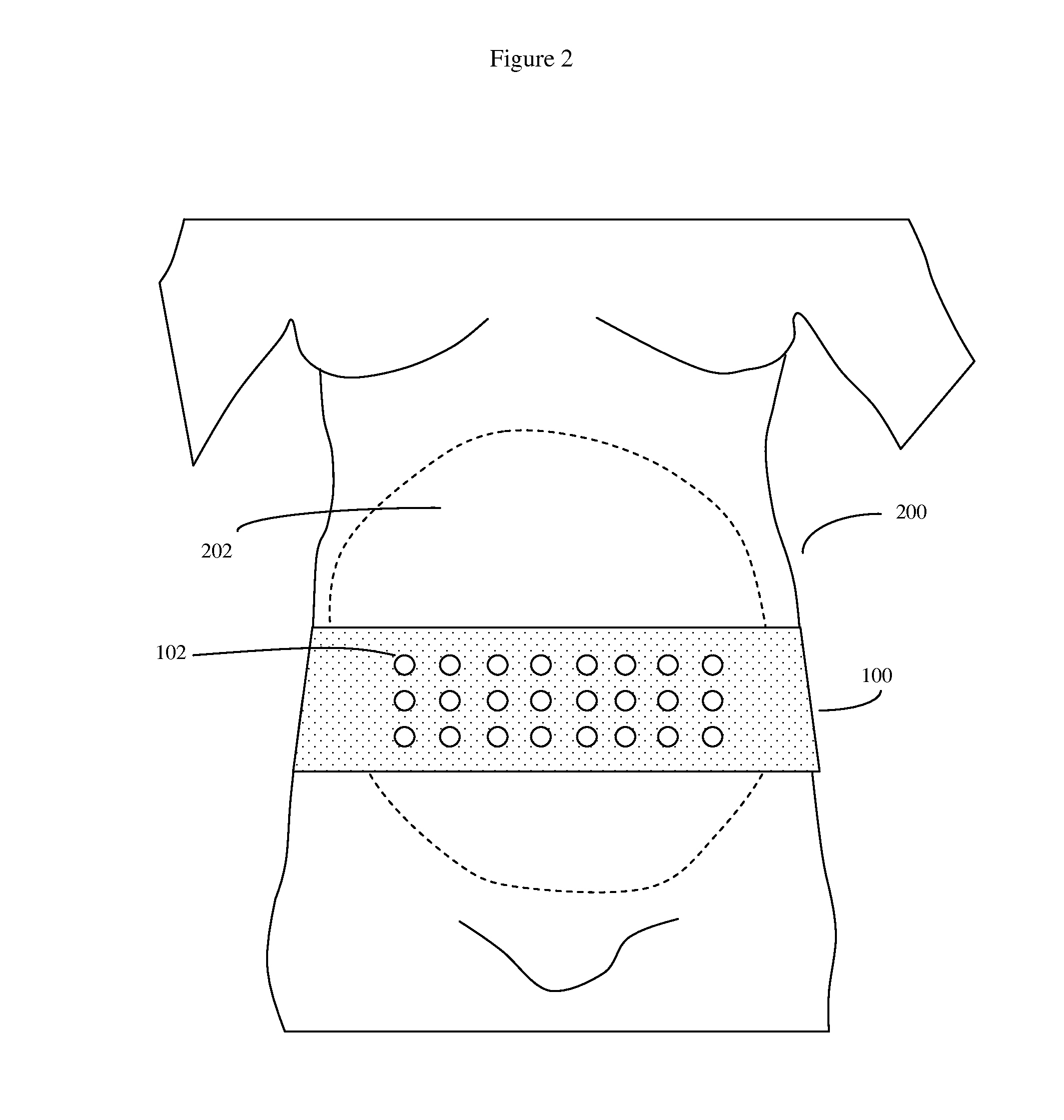 Extended use home uterine activity monitor