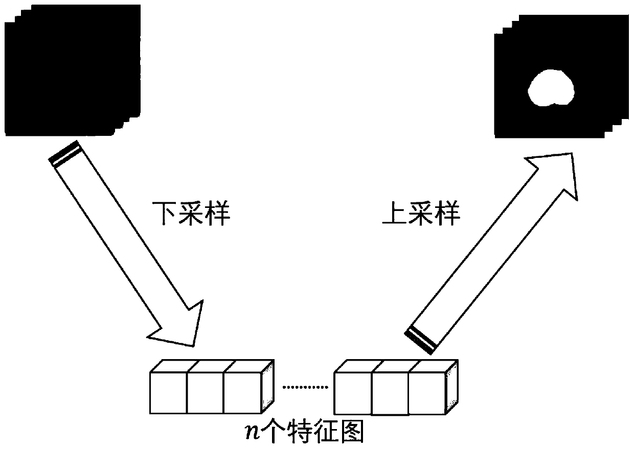 Image feature acquisition method of prostate MRI three-dimensional image