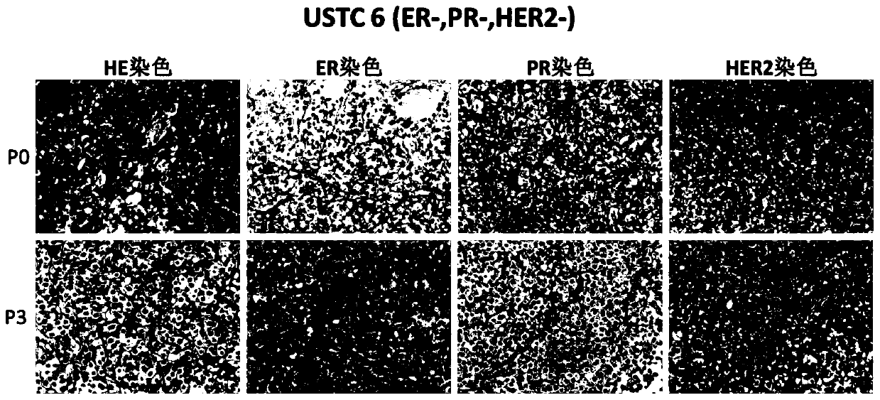 Construction method and application of xenograft tumor models derived from different subtypes of Chinese breast cancer patients