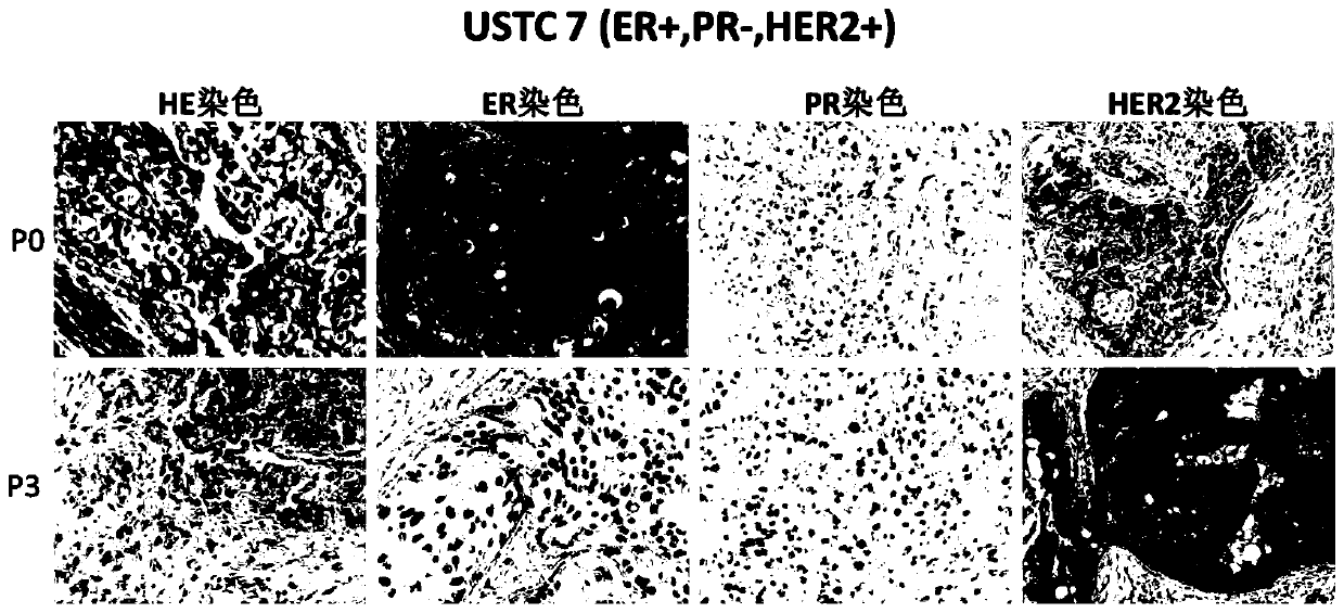 Construction method and application of xenograft tumor models derived from different subtypes of Chinese breast cancer patients