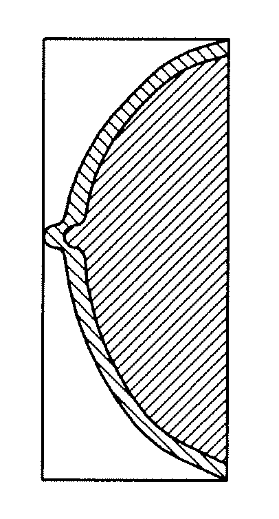 Method, apparatus and program for processing mammographic image