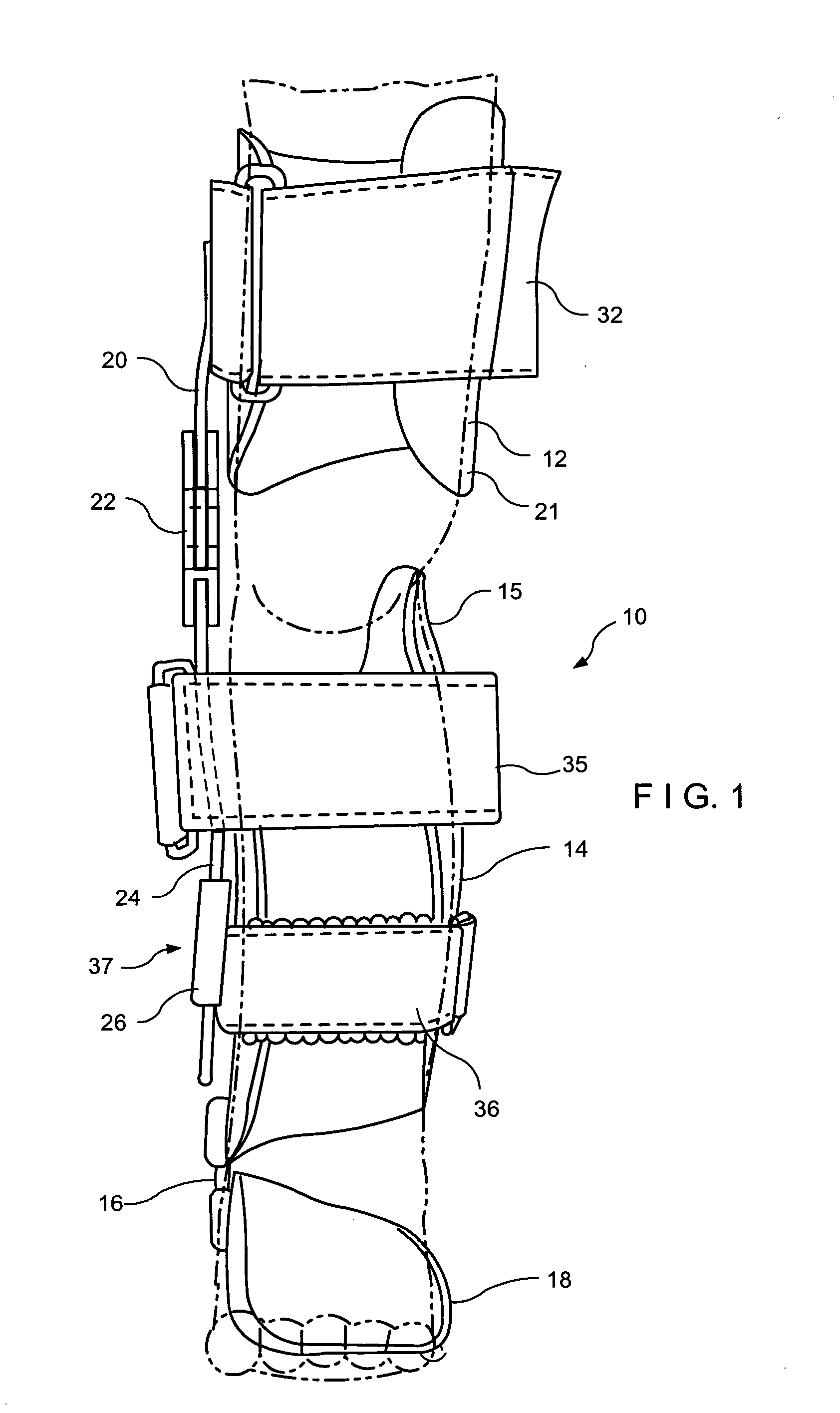 Apparatus for correction of leg deformities