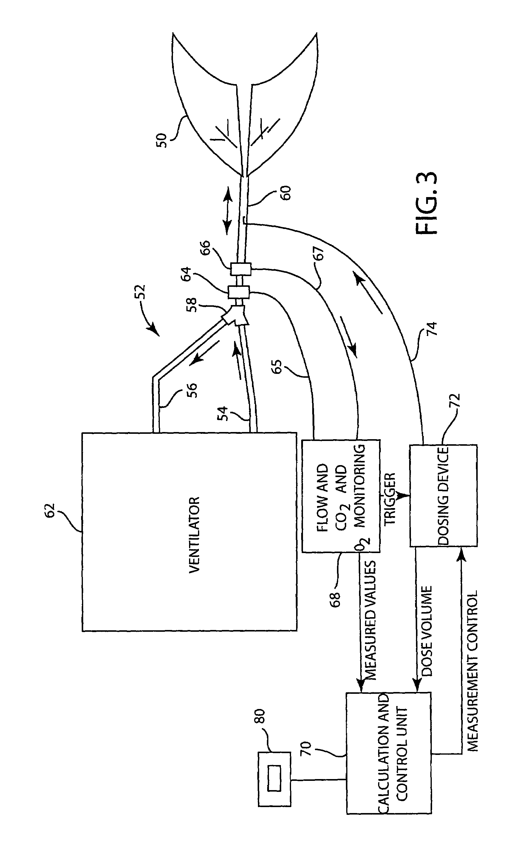 Non-invasive determination of conditions in the circulatory system of a subject