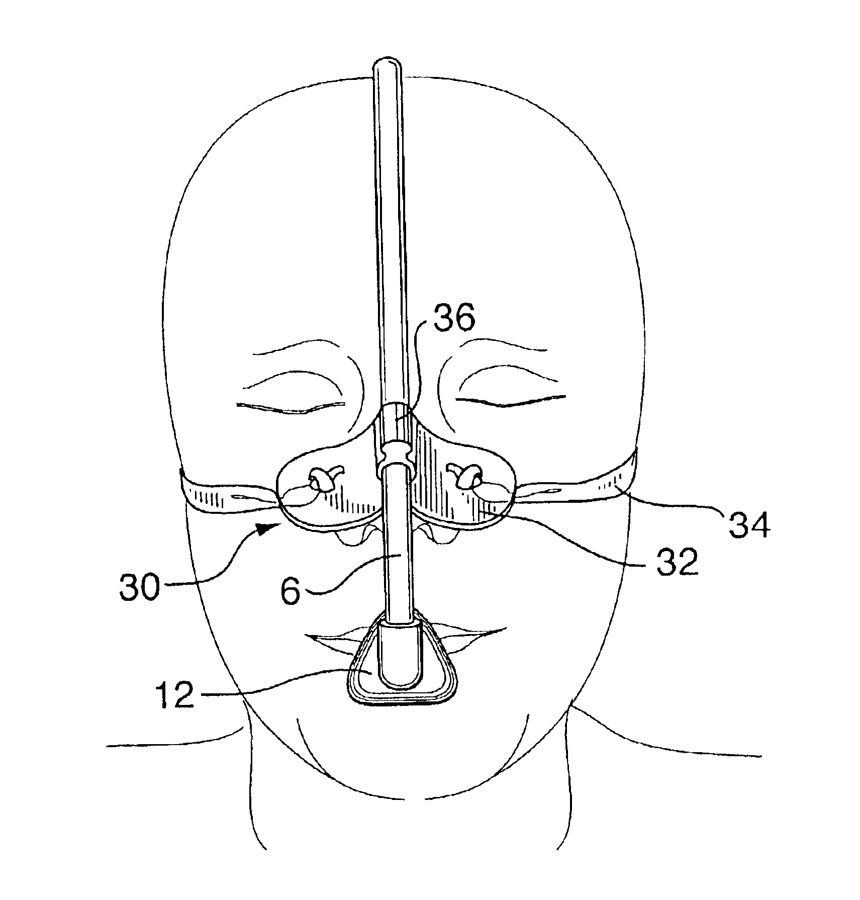 Lightweight oxygen delivery device for patients