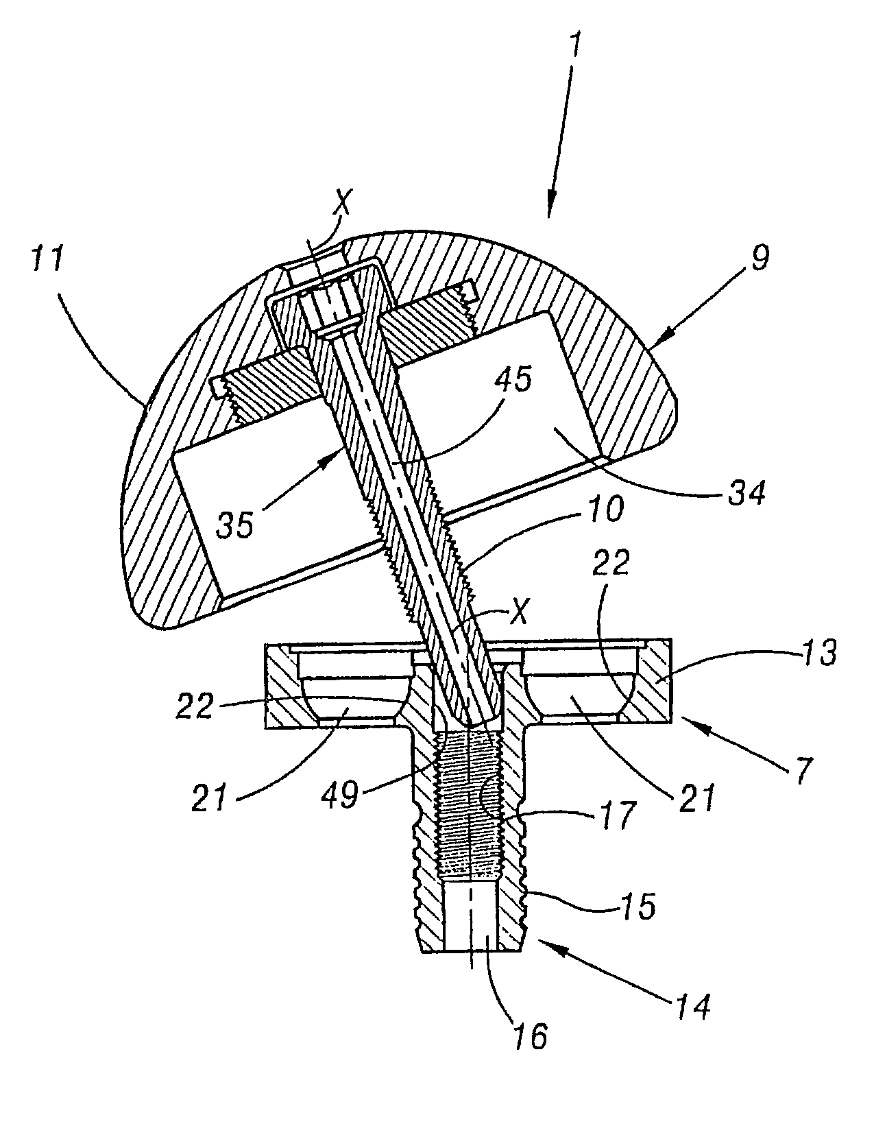 Shoulder prosthesis assembly