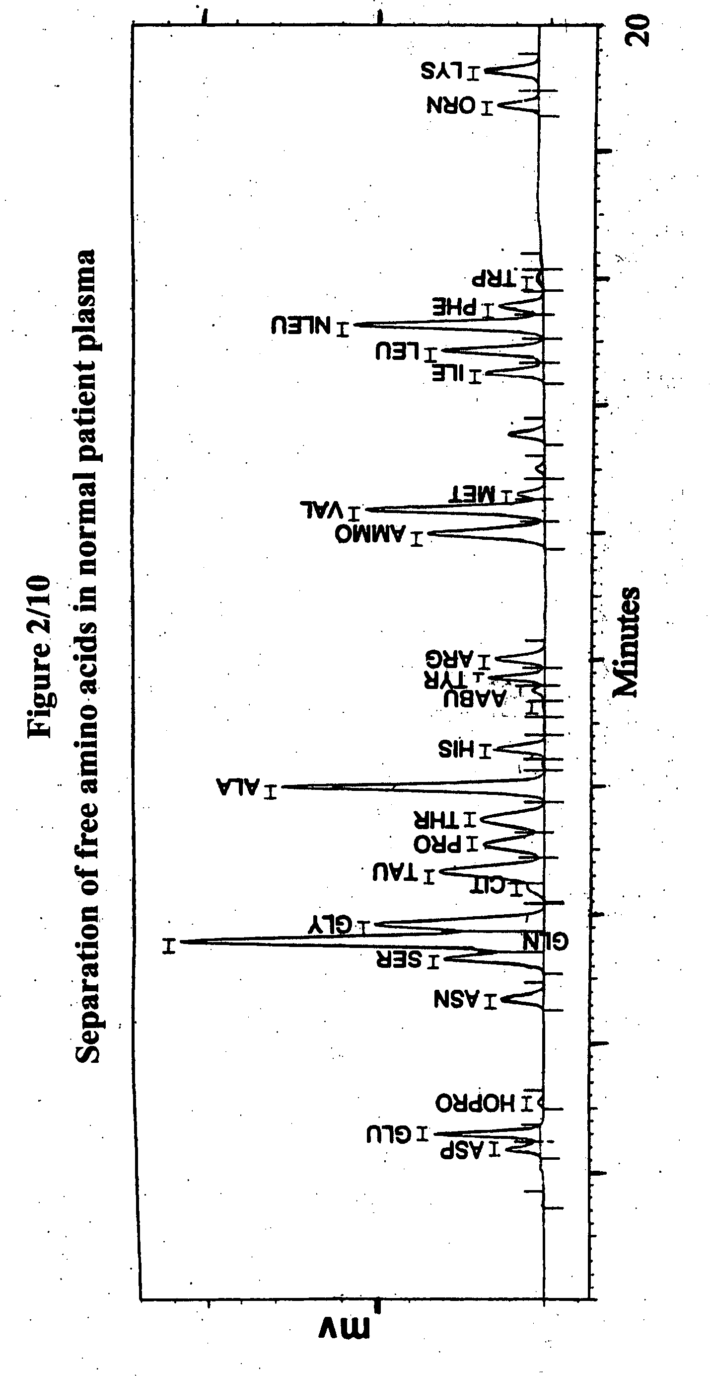 Human plasma free amino acids profile using pre-column derivatizing reagent- 1-naphthylisocyanate and high performance liquid chromatographic method