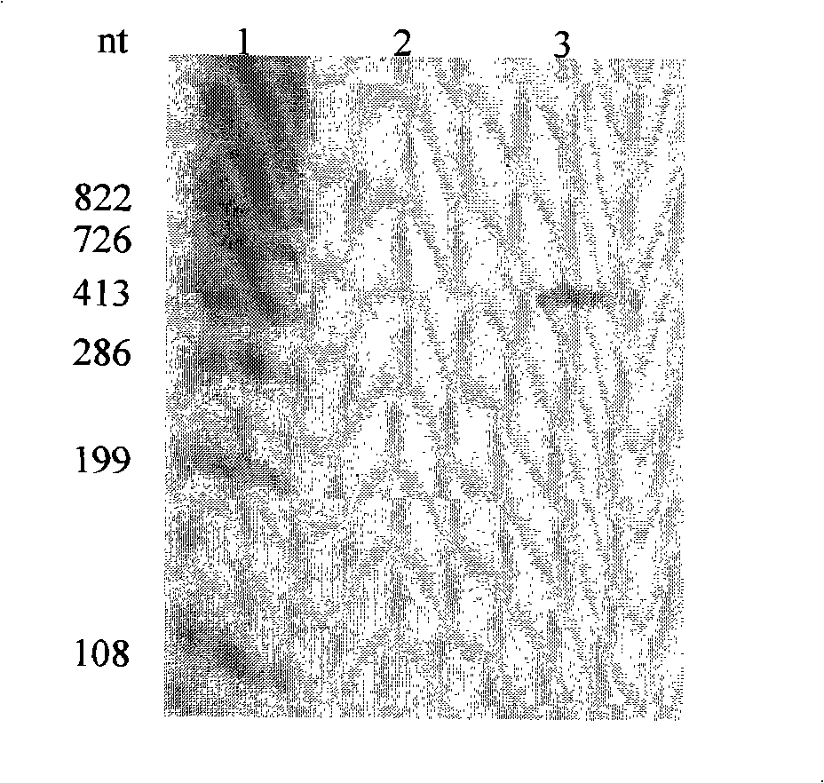 Method for constructing hepatitis C virus specific ribozyme M1GS-hcv/C67 and uses thereof