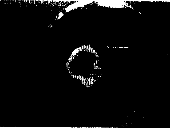 Method for preparing epithelium of autologous cornea