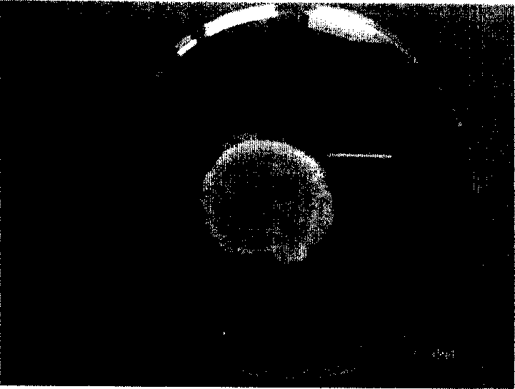 Method for preparing epithelium of autologous cornea