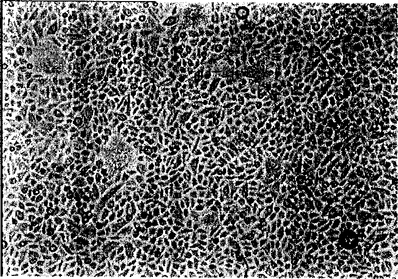 Method for preparing epithelium of autologous cornea