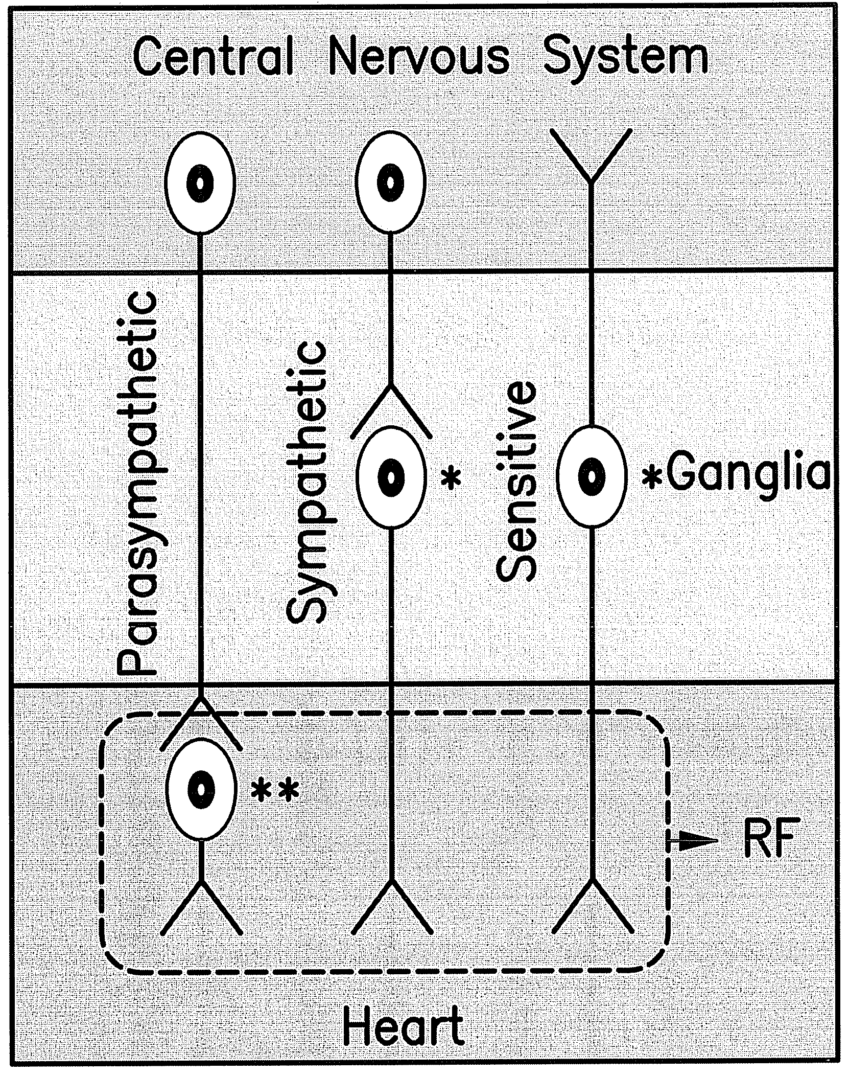 Method for arrhythmias treatment based on spectral mapping during sinus rhythm