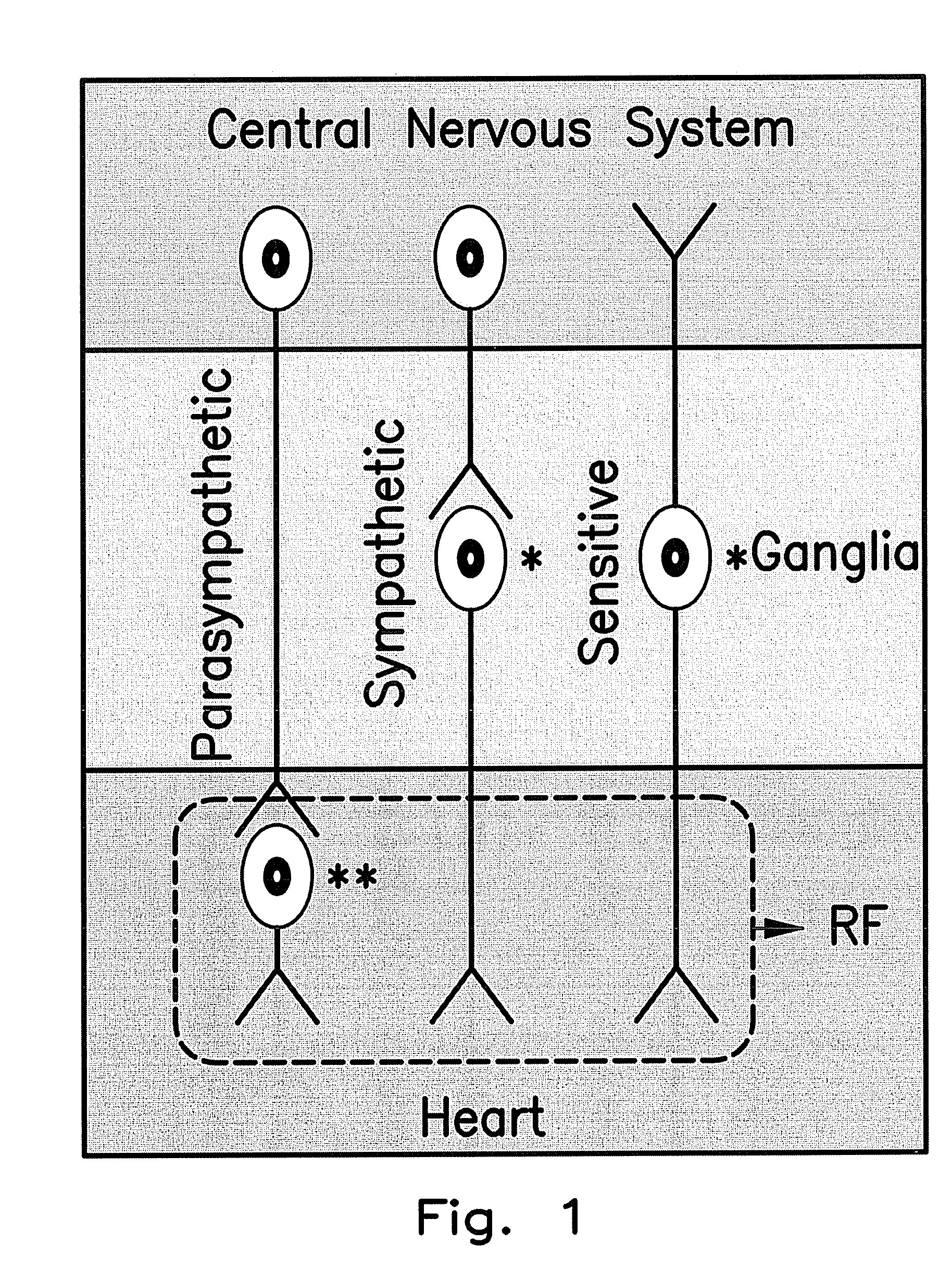 Method for arrhythmias treatment based on spectral mapping during sinus rhythm