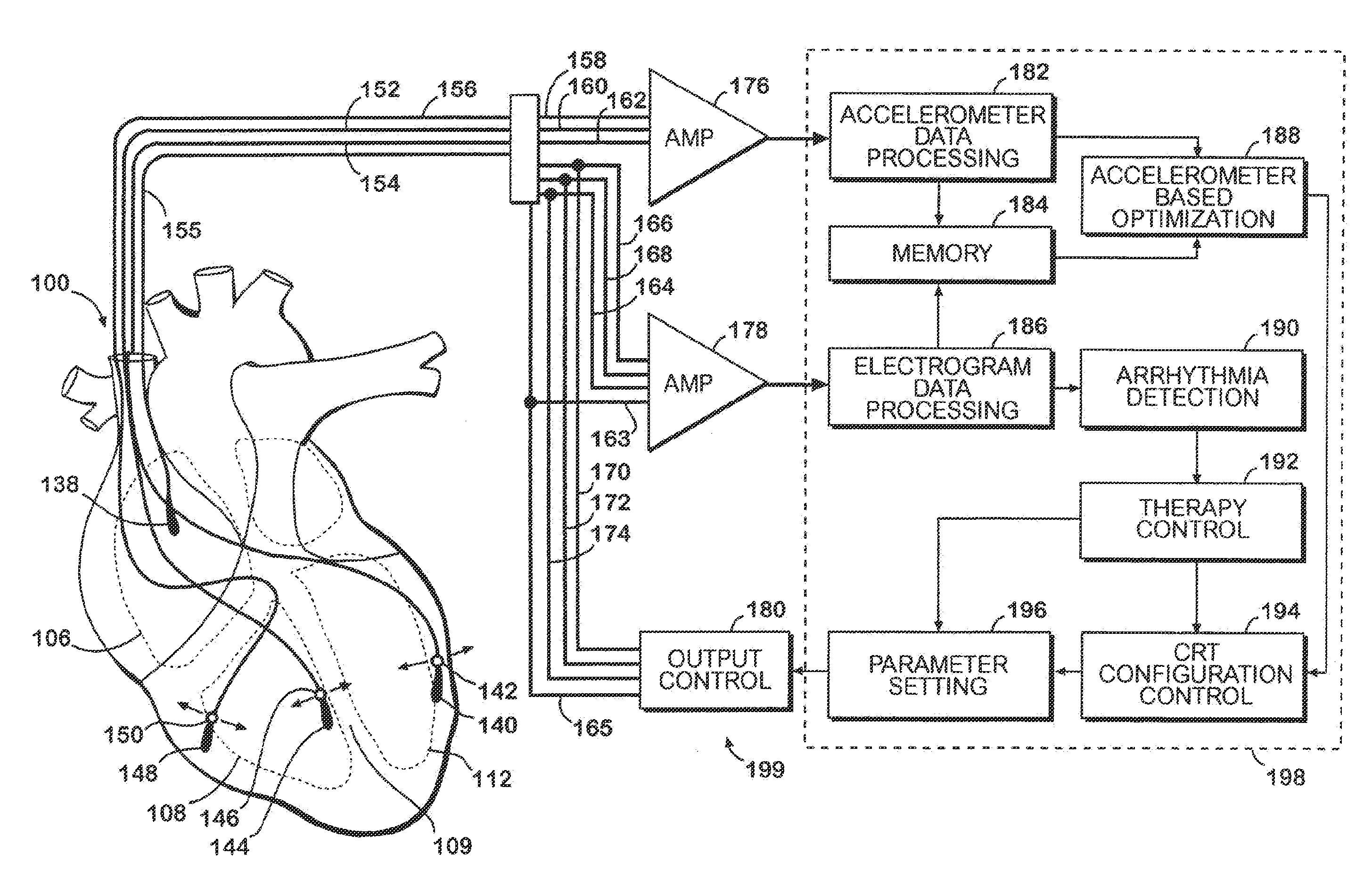 Cardiac resynchronization system employing mechanical measurement of cardiac walls