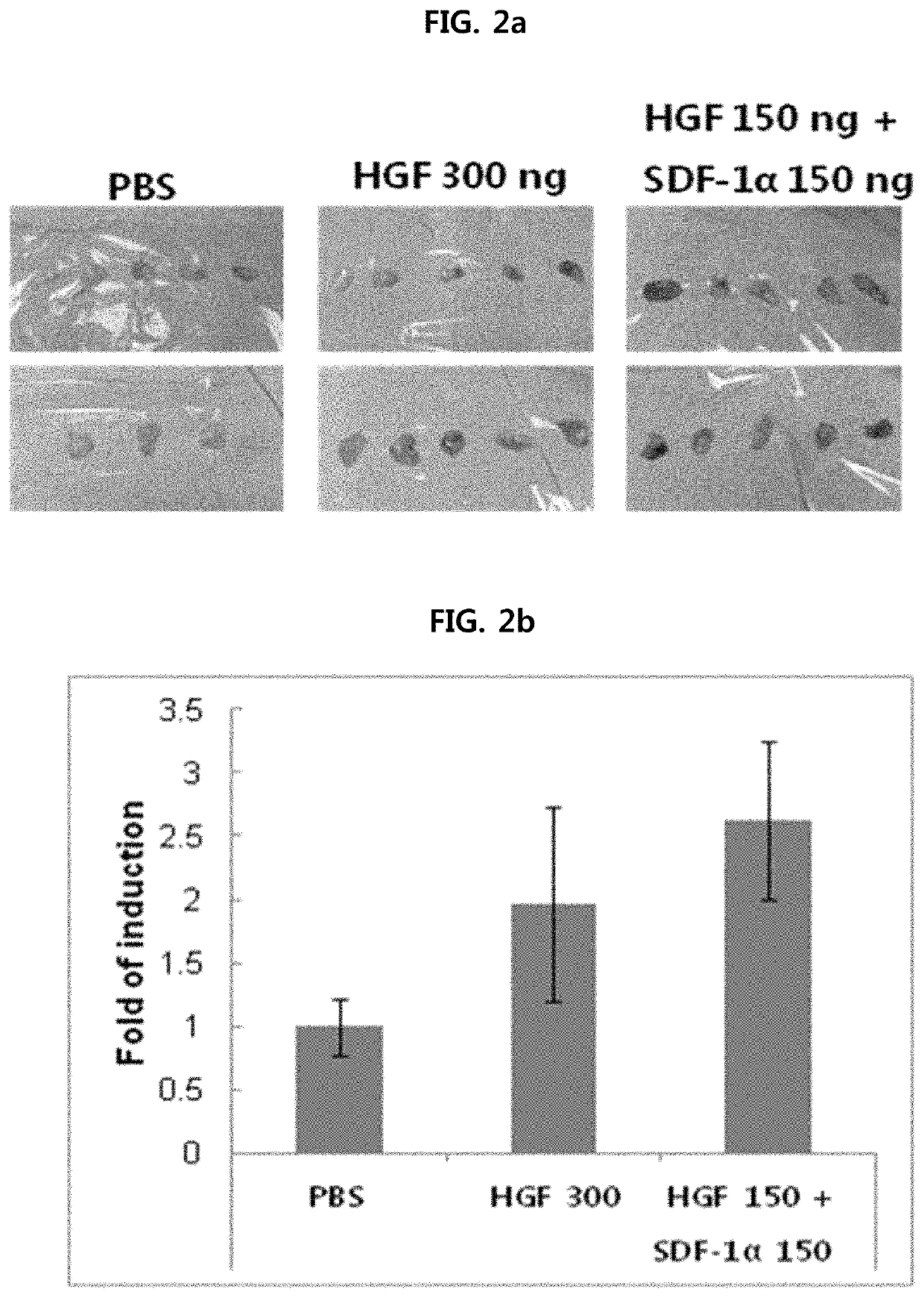 Method for treating peripheral vascular disease using hepatocyte growth factor and stromal cell derived factor 1A