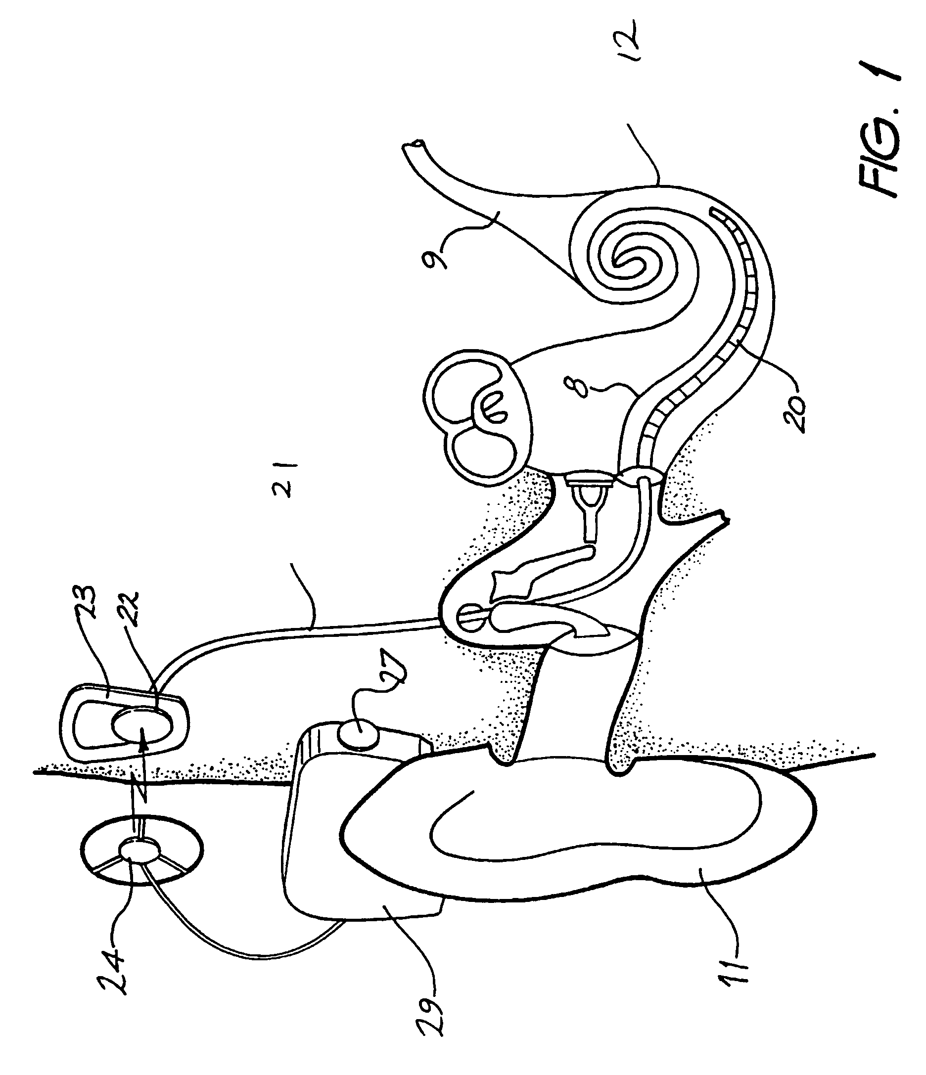 Curved cochlear implant electrode array