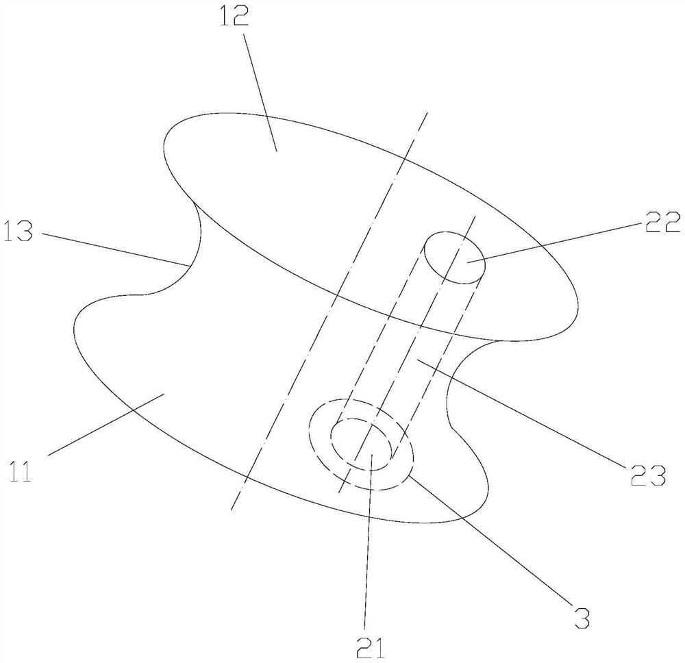 An adjustable heart defect occluder