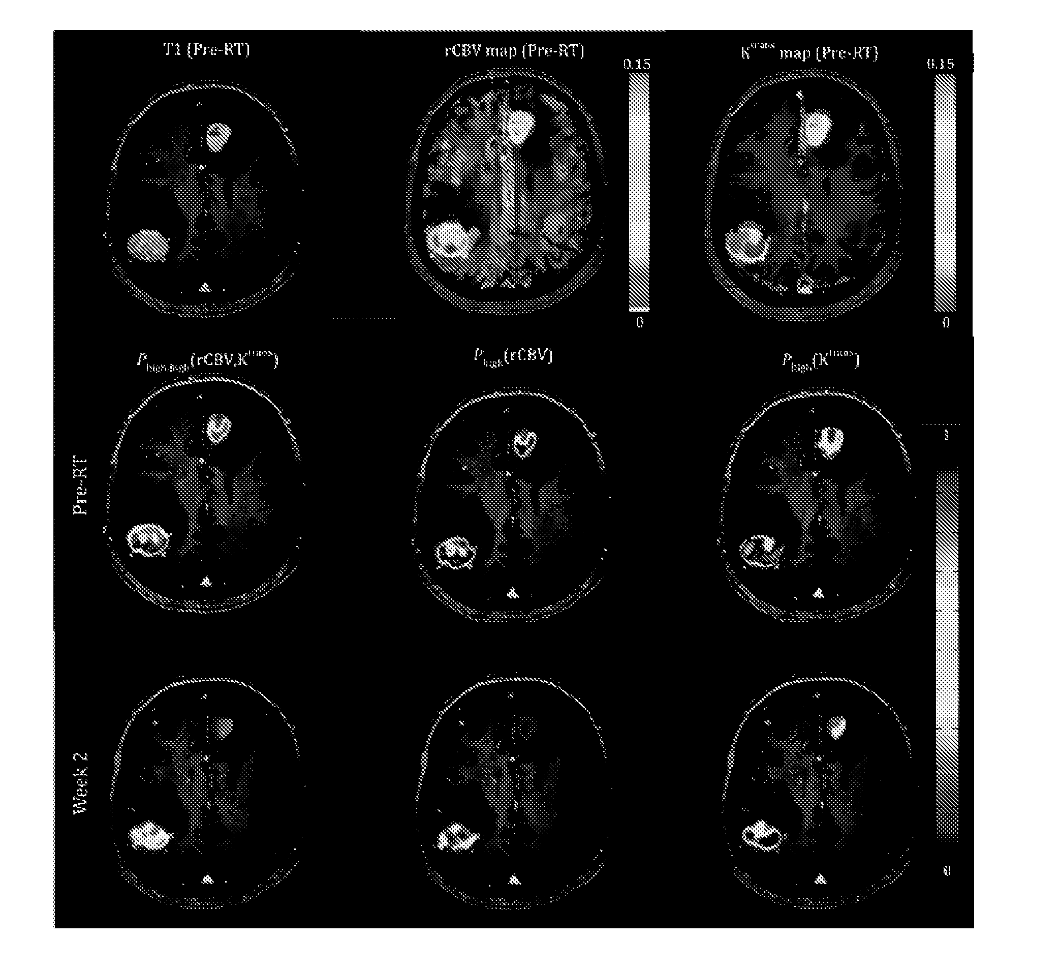 Subvolume identification for prediction of treatment outcome