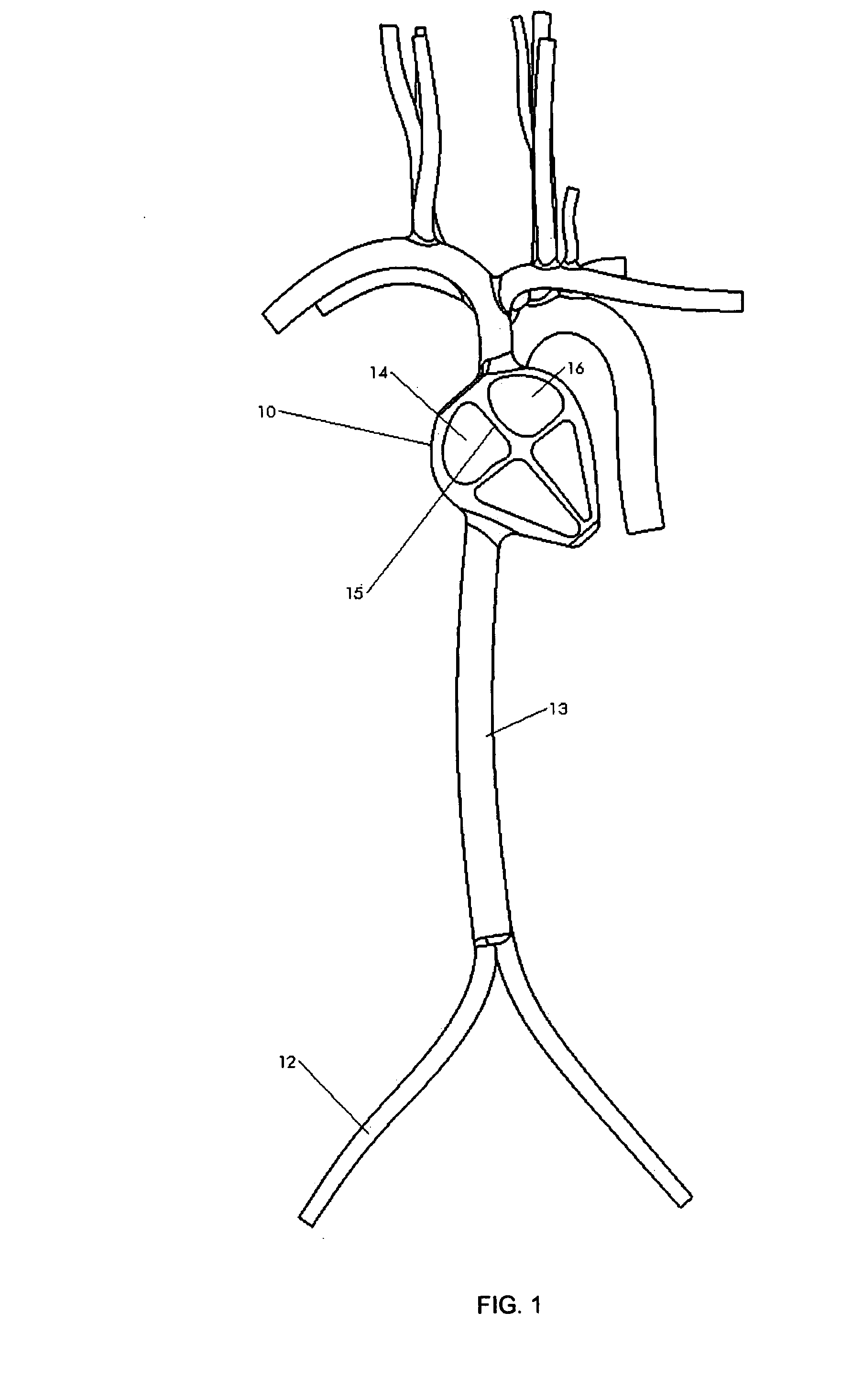 Implantable device for delivery of therapeutic agents