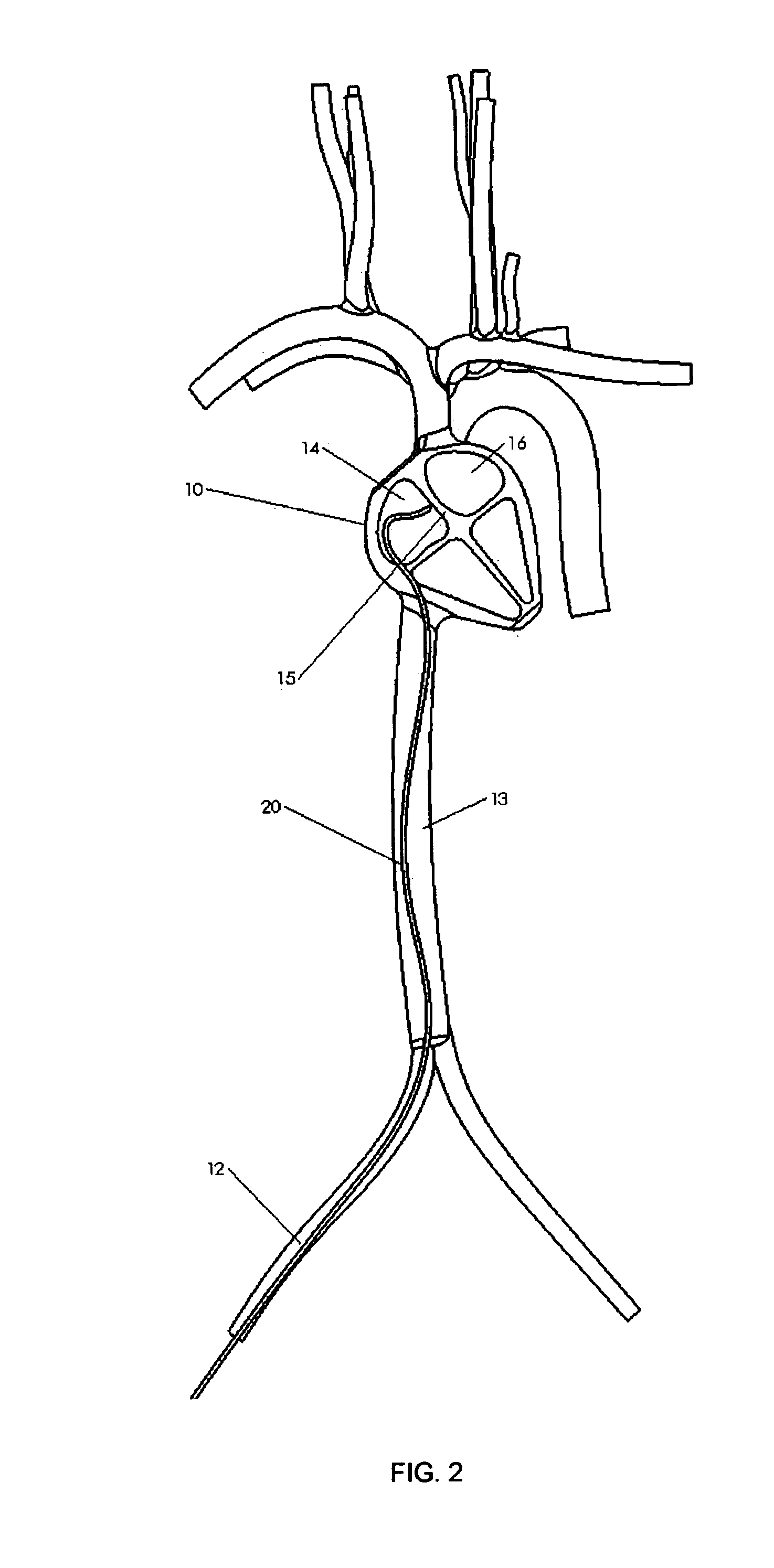 Implantable device for delivery of therapeutic agents