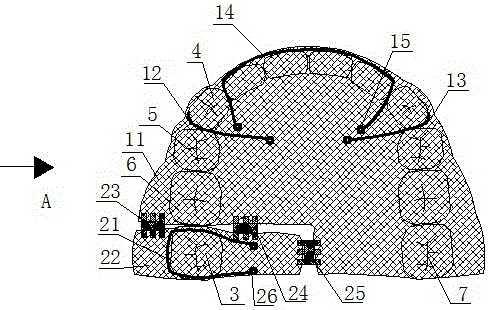 Mixed-dentition maxillary occlusal pad molar distal jet