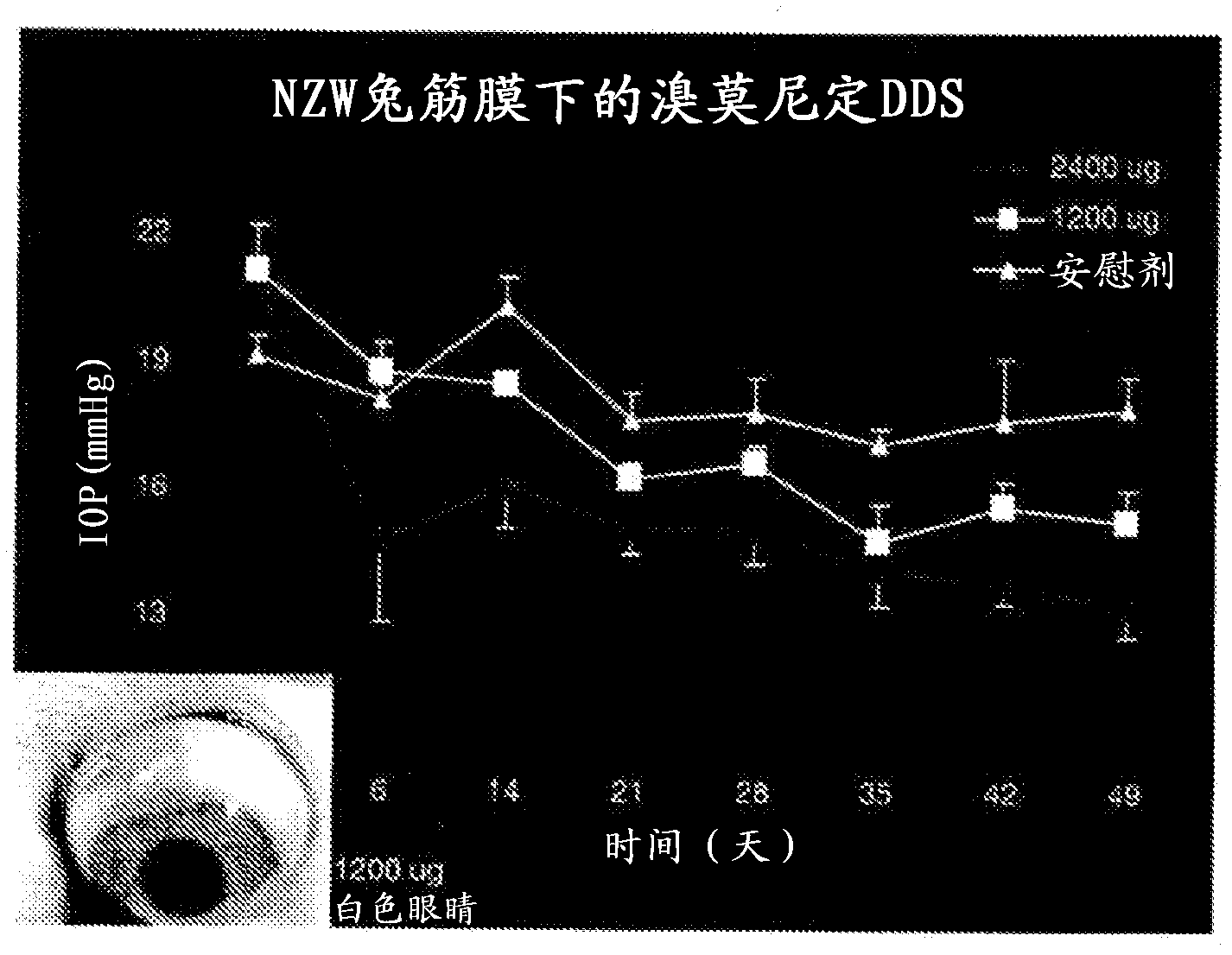 Intraocular drug delivery systems