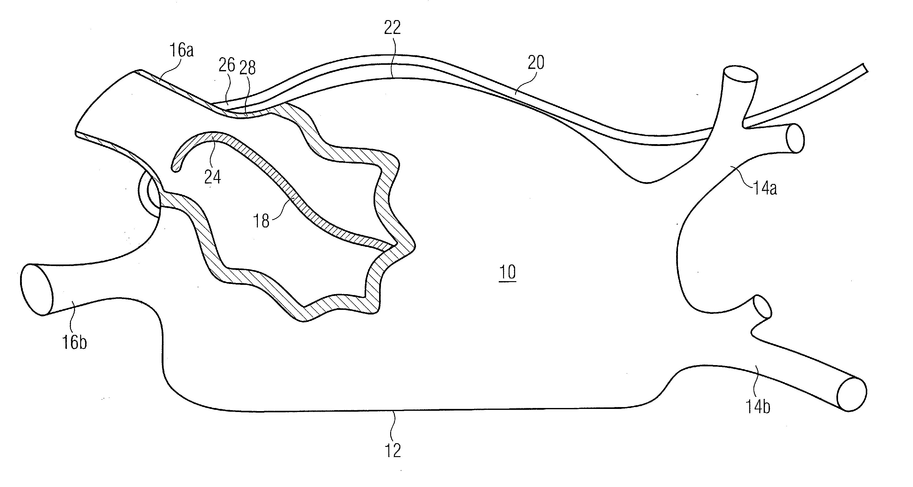 Pair of endocardial and epicardial catheters, catheter and method for positioning electrodes on a cardiac wall and method for the ablation of cardiac muscle tissue