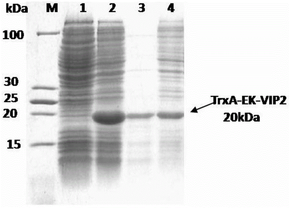 Antibacterial peptide VIP (vasoactive intestinal peptide)-like peptide and preparation method thereof