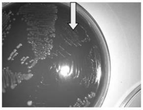 An optimized isolation method of human intestinal probiotics