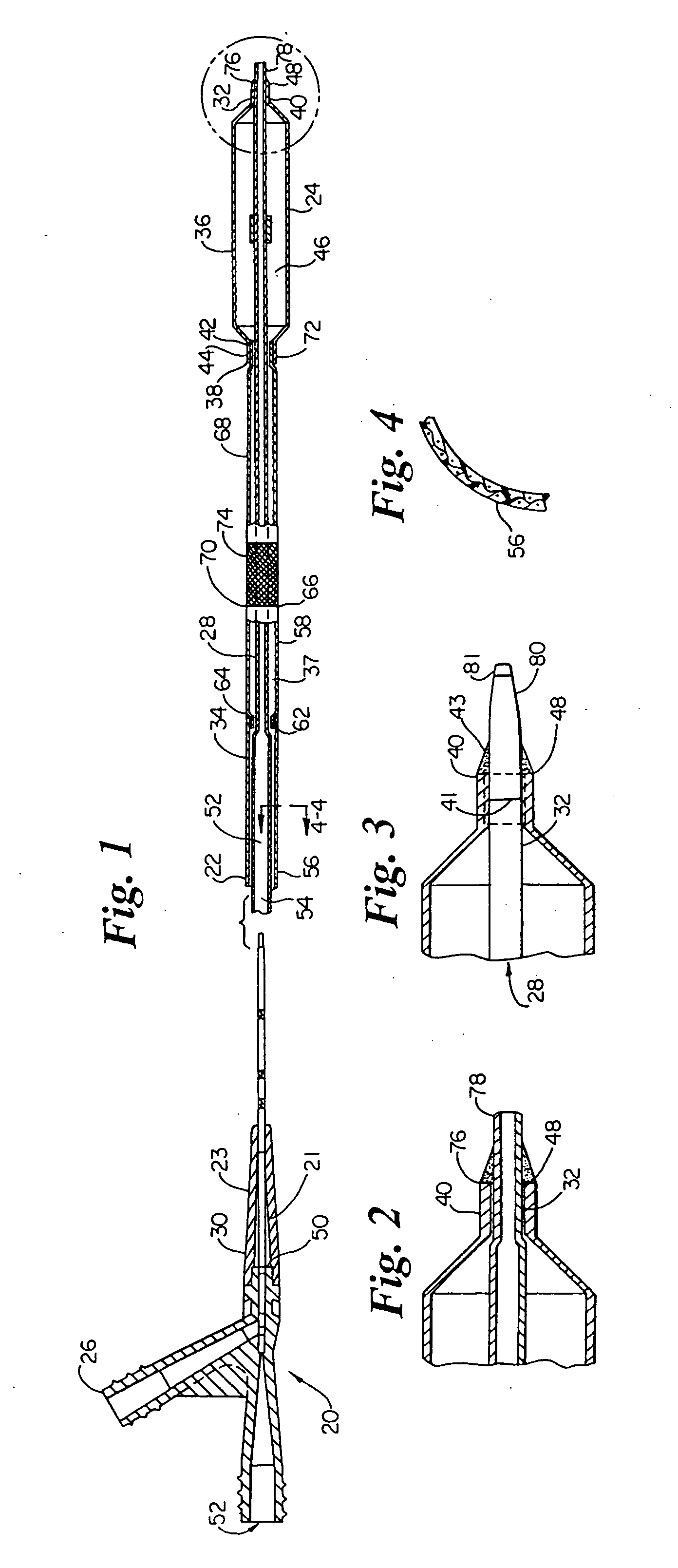 Catheter with spiral cut transition member