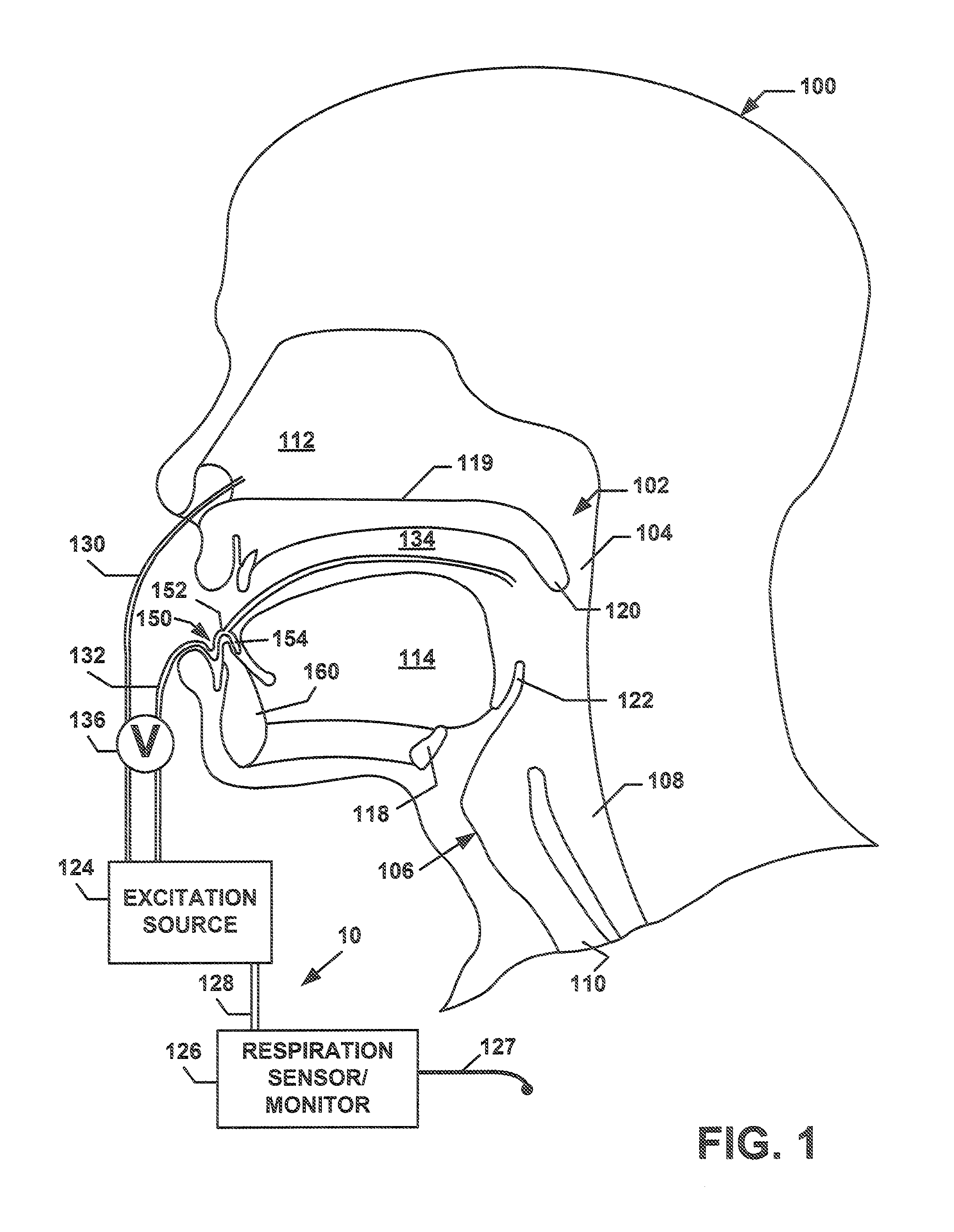 Discontinuous Positive Airway Pressure Device And Method Of Reducing Sleep Disordered Breathing Events