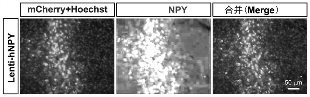 Vectors and reagent for constructing hNPY gene overexpression chimeric animal model and application