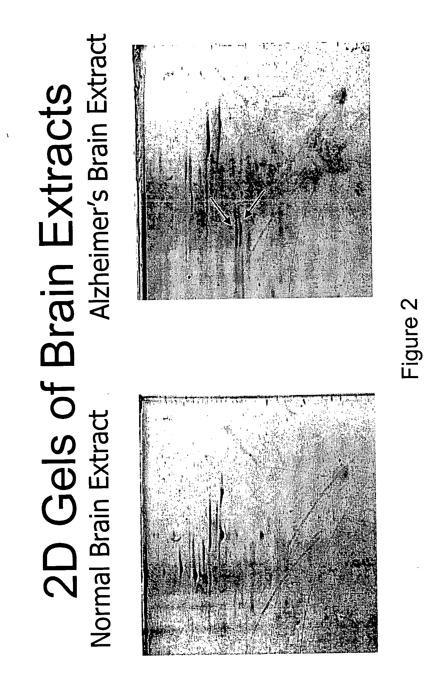 Method for retarding or precluding Alzheimer's dementia