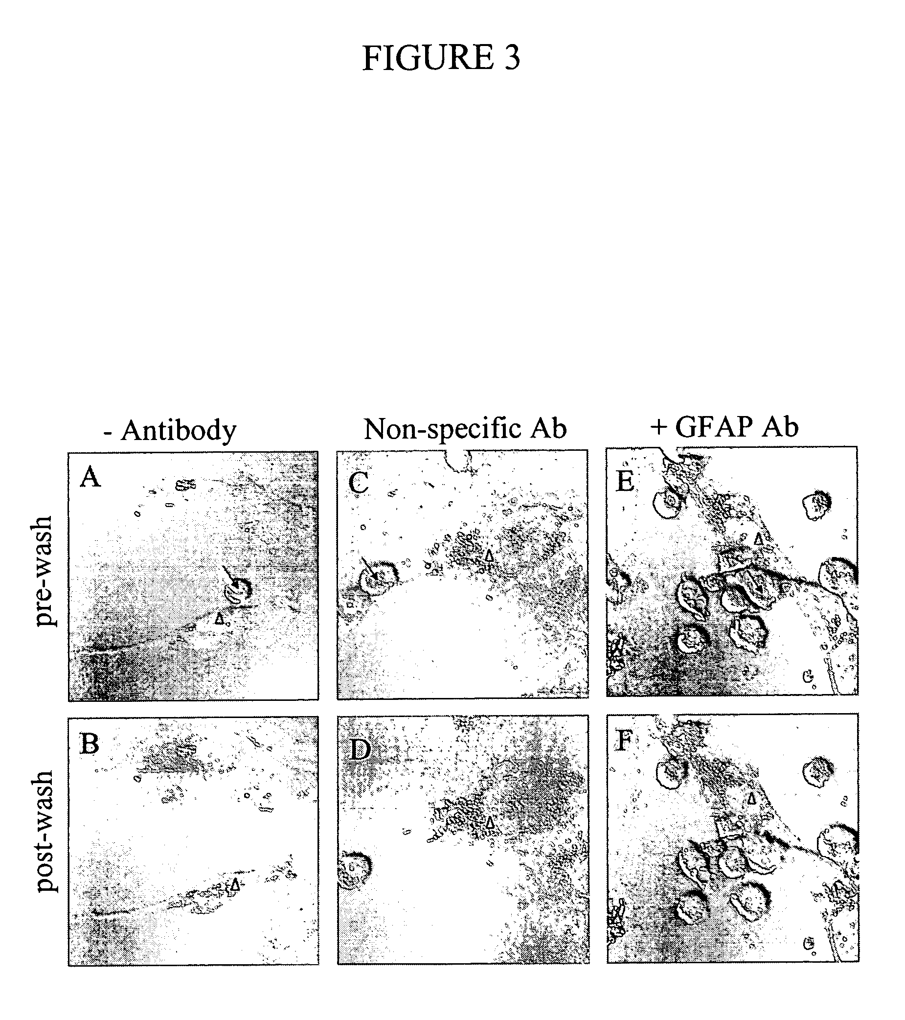 Method for retarding or precluding Alzheimer's dementia