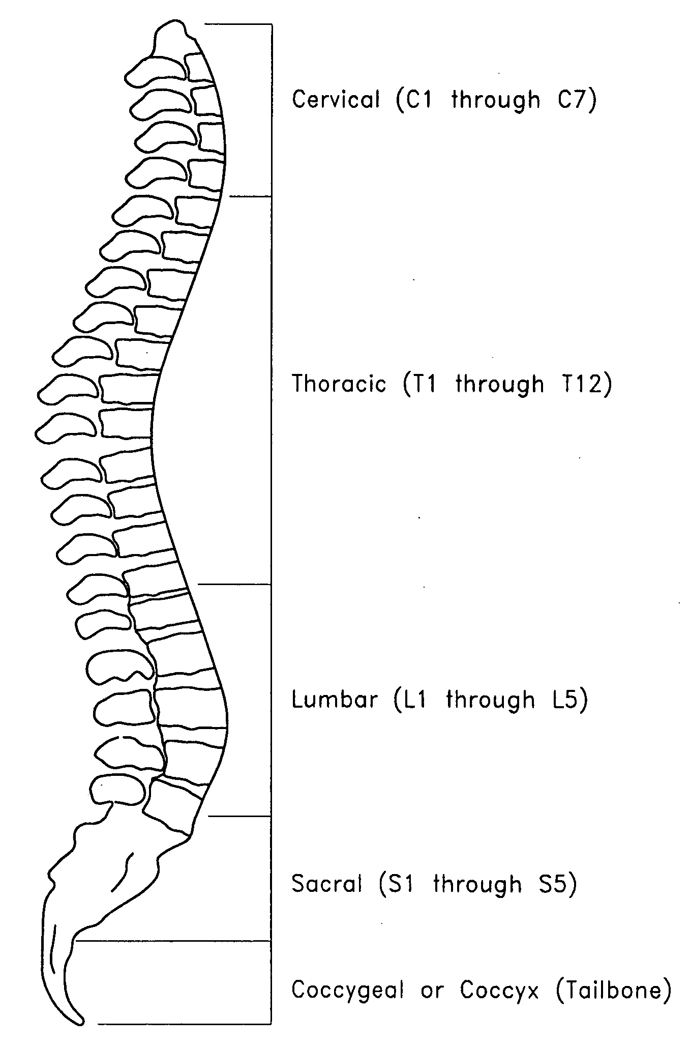 Bone dilator system